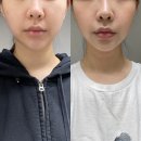 메디투 | 쿠쿠 메디킨하이 여배우디바이스로 8주간 매일 관리해본 후기
