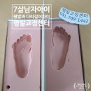 7살 남자아이 평발교정 - 다리길이차이와 평발교정 , 평발교정센터가 함께 합니다.