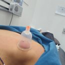 통영잘보는한의원 진짜 잘하잖아? 내돈내산