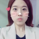 에이스 헤어라인 이미지