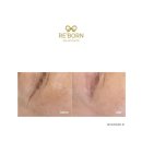 다시태어나는곳 ribbon spa아니고요. Reborn spa. 리본스파에스테틱입니다.