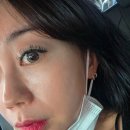 자르세 헤어/스킨휴 | 의정부 피부과 처음 맞아보는 스킨보톡스 내돈내산 리얼후기 통증 멍