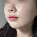 소프니스 이미지