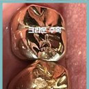 가든 치과기공소 이미지