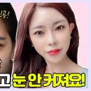 20대 이마거상술, 3개월차 경과! 어떻게 달라졌을까요?(15만명이 선택한 바로 그분!) 이미지