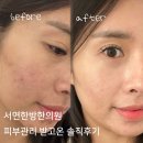 햇살한의원 | 서면 여드름 한방치료 피부 한의원 후기 재방문