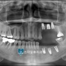 스마일홍치과의원 이미지