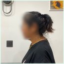 디스크닥터 목견인기 거북이 되기 전 집에서 간편 사용 후기