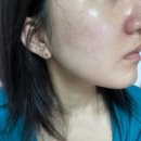 서울에스와이피부과의원 이미지