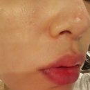 노화방지화장품 : 쌩얼자신감! 미백관리 &#34;클로레 스노우 CO2 솔루션 키트&#34; 솔직후기