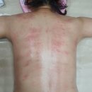안산 체형관리샵 제니스타힐링포유 에서 건강해졌어요 : )