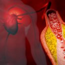 Fitness 6.3 이미지