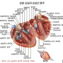 정맥혈관 질환과 치료 이미지