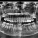 의정부본플란트치과의원 이미지