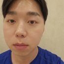 베이드의원 | 강남언니 앱 LDM관리 솔직 후기 수부지 피부의 가성비 수분충전