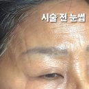 &#34;마벨 브로우&#34; 김바니 대표원장 님께 받은, 작은누나의 눈썹 시술