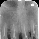 엔도코어 이미지