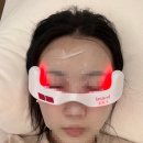 아이리안경 | 아이리쥬브]눈밑지방재배치 고민하다 먼저산 아이리쥬브 내돈내산 후기(+가장 싸게 사는법, 6월할인)