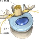 서재곤링커병원 | 허리 아플 때 꼭 알아야 할 허리디스크 정보 초기증상·원인·관리 총정리