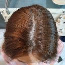 오성당한의원 | [탈모치료한의원]오성당한의원후기 +모근관리법