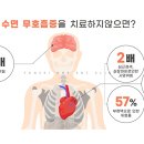 서울수면센터 이미지