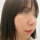 엘불리 | 판교피부관리 에스테틱 엘부티끄 피부컨설팅으로 피부고민 해결