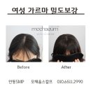 모채움스칼프