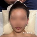홈정통스파체형관리 | 청담동 에스테틱 웨딩 윤곽관리 후기 “스파나무 청담 본점” 땅콩형 얼굴