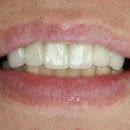 이치과기공소 이미지