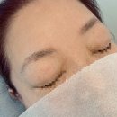 흥케이병원(흥K병원) | 문신 잘하는곳 찾고있다면 꼭 보세요 망한 엄마눈썹 자연스럽게 복구한 시흥능곡뷰티케이 내돈내산 후기
