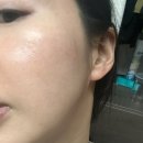 재생앰플 추천 닥터에스지엔 PDRN 퍼펙트 앰플 피디알엔 앰플 PDRN 뜻 효과