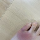 연세에이치의원 | [영통/피부과]연세에이치의원 연세H의원 솔직후기/ 지네물린 후기