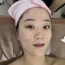 스킨리에 | 💆🏻‍♀️[대구] 수성구 얼굴 경락 잘하는 곳 "스킨리에" - 얼굴윤곽관리 후기