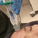 에스디피부과 | 강남피부과 물광주사 내돈내산 후기 속건조