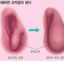 코막힘 뚫는법 자세 코 막혔을때 원인 알아봐요 이미지