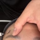 라플러스에스떼 피부관리 후기