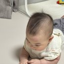 멍머리 | 아기 낙상사고 후 은평성모병원 응급실(머리혹, 멍, 비용)