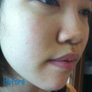 민CARE1 이미지