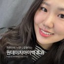 아름다운시간치과의원 | 강남 레브치과의원 원데이치아미백 내돈내산후기 | 당일부터 1주일 후 변화