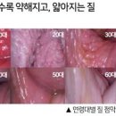 관계후 질출혈 원인 피가 나와요 이미지