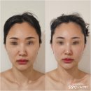 신안아파트 앞 상가 | 검단 김포웨딩관리 라파에스떼 김포풍무점