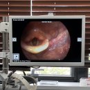 프라나이비인후과의원 | 대흥 '프라나이비인후과의원'에서 후두염과 기관지염 진단 받았어요