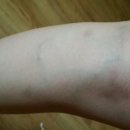 아나파적맥통증의원 이미지