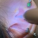 평남농장 | 내돈내산 : NEW 예인 LED 귀이개 귀지핀셋 귀후비개 5종 풀세트 / 솔직후기