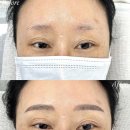 광주양산초등학교 | 광주눈썹문신 벨르뮤 | 아침 인상 고민 해결한 대칭 상담 후기, 남자도 소개하고 싶었어요