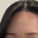 희헤어라인 이미지