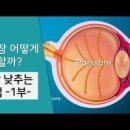 안압이 높으면 효능 및 증상 높아지는 이유 낮추는법 이미지