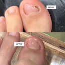 온고을로 | [전주] 고통 끝! 전북 유일 아크릴 내성발톱 관리 '홀드핀칭 네일제작소' 솔직 후기