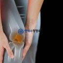 세교정형외과의원 네이버블로그