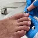 레푸스&아트포레 | 해운대 무좀발톱 전문 레푸스 해운대중동점 위치 주차 정보부터 친절한 관리사님 후기까지 총정리